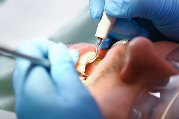Best After-Hours Emergency Dentist in Sebewaing, MI